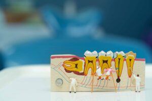 虫歯、歯周病の模型と、その前で小さな人形が作業をしている