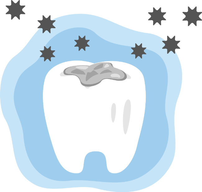 詰め物が密着してなくて隙間から菌が入るイメージ